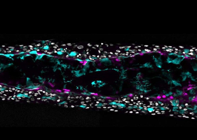 Un nouveau modèle d’organoïde pulmonaire pour mieux comprend ... Image 1